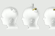 머스크 "뉴럴링크 '뇌 이식용 칩' 내년 인간에 적용 희망"