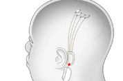 일론 머스크 "8월 28일, 신경 발화 실시간 중계"